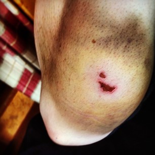 Basecamp Photo - War Wound.jpg